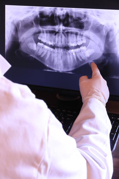 Best Emergency Dentist for Lost Fillings or Crowns in Keedysville, MD